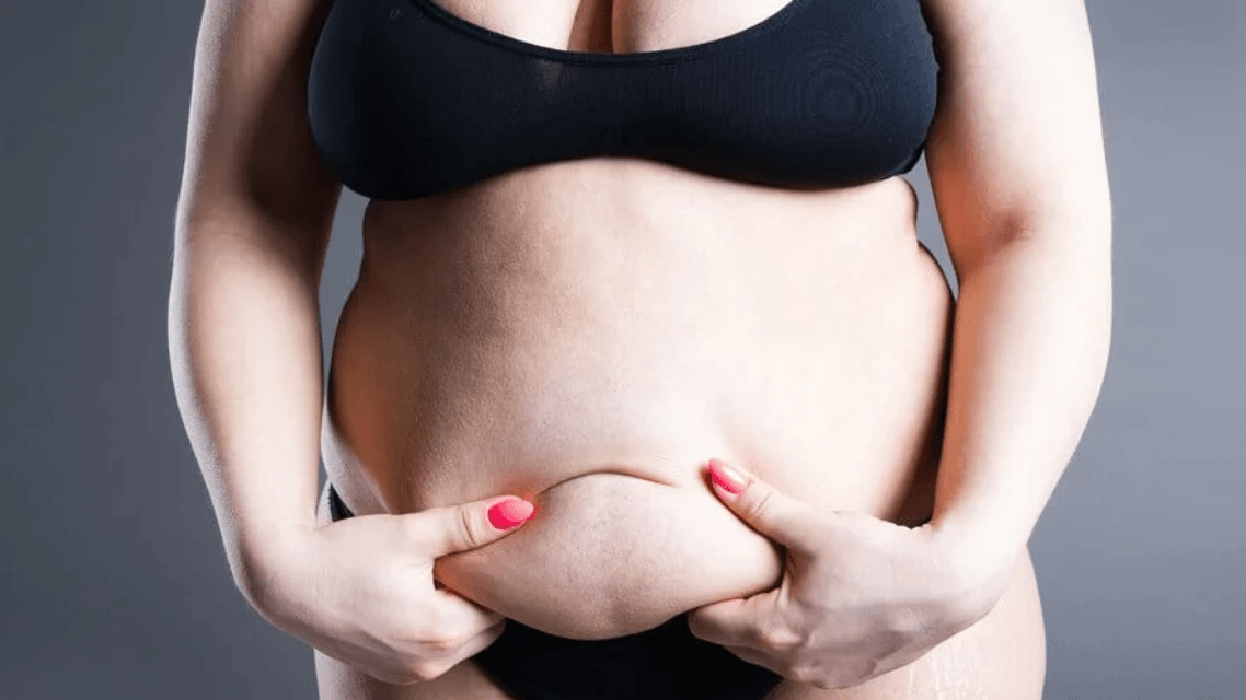 Lipödem erkennen: Was Betroffene über die Symptome wissen sollten