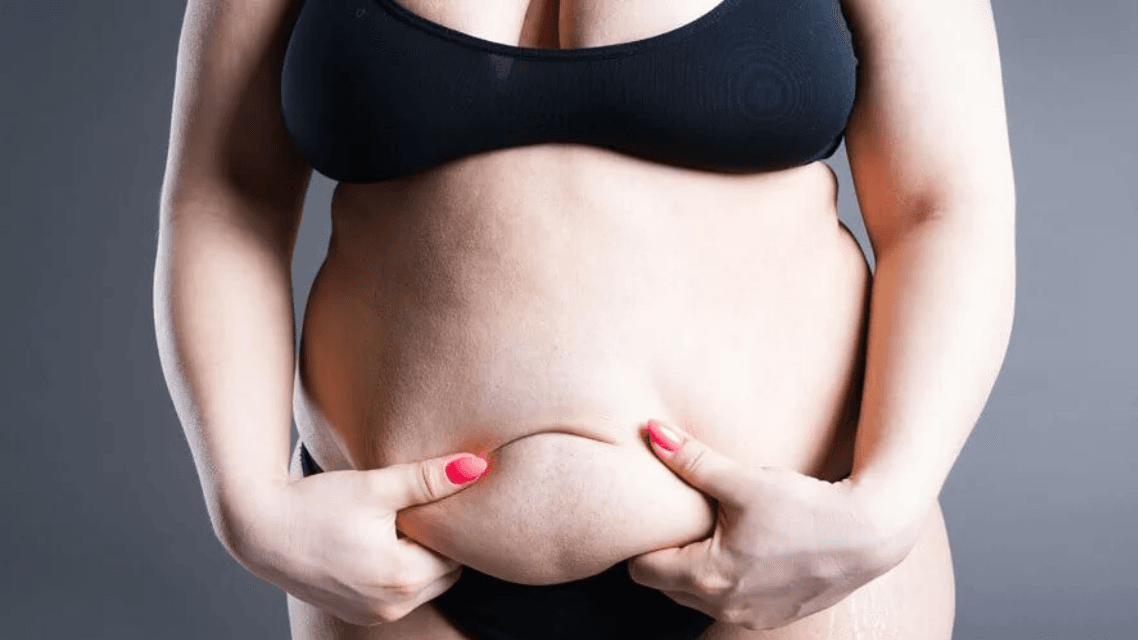 Lipödem erkennen: Was Betroffene über die Symptome wissen sollten