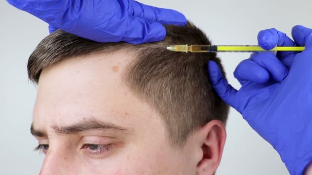 Haartransplantation türkei für Afroamerikaner: Spezielle Überlegungen und Ergebnisse